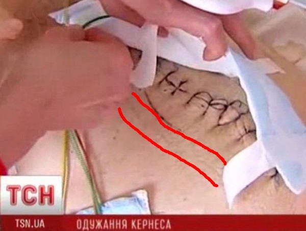 кернес2.JPG